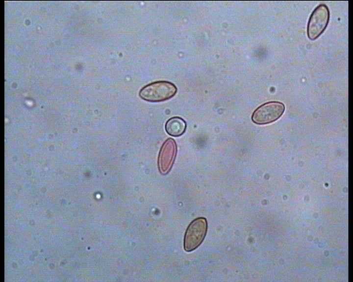 Winkel   ( FRA )   28.08.2004    1 Serie